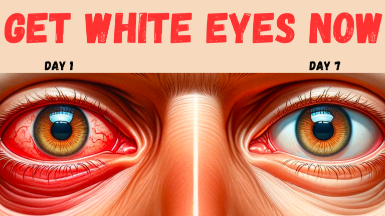 Bright Eyes in Days: Achieve Full White Eyes Now!